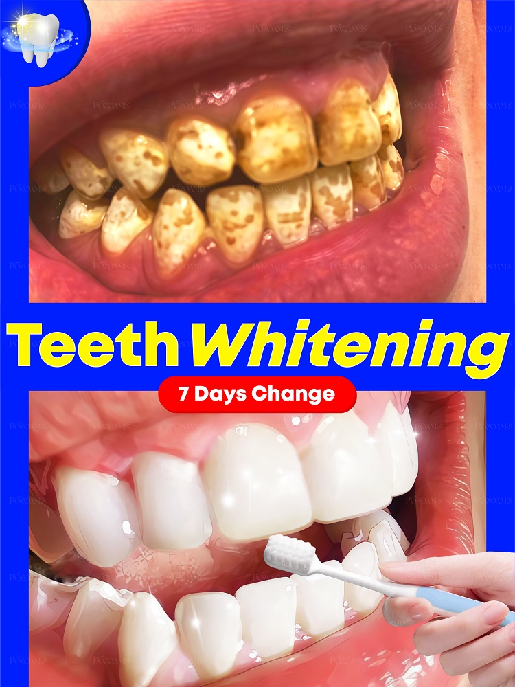 Teeth Whitening Effective - 2025 nouvelle technologie noire pour blanchir