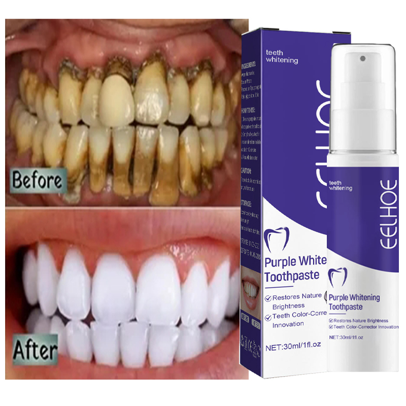 Teeth Whitening Korea - Dentifrice blanchissant pour le nettoyage des
