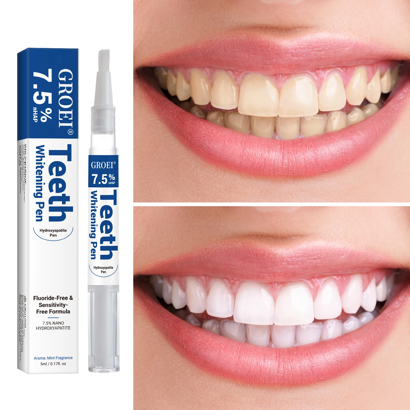 Stylo de blanchiment des dents - Teeth Whitening Gels Used By Dentists avis et prix