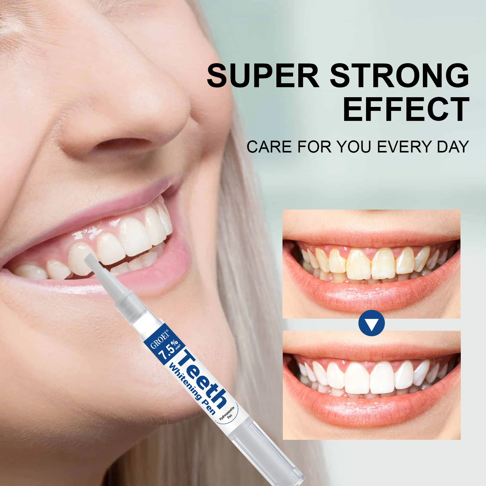 Stylo de blanchiment des dents - Teeth Whitening Gels Used By Dentists avis et prix