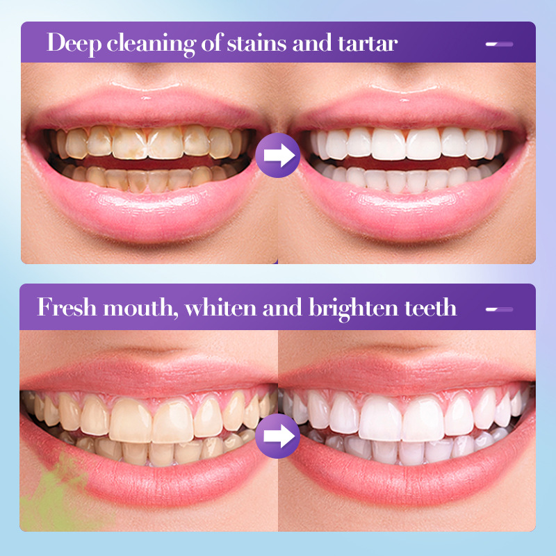 Dentifrice blanchissant best-s - Teeth Whitening Effective avis et prix