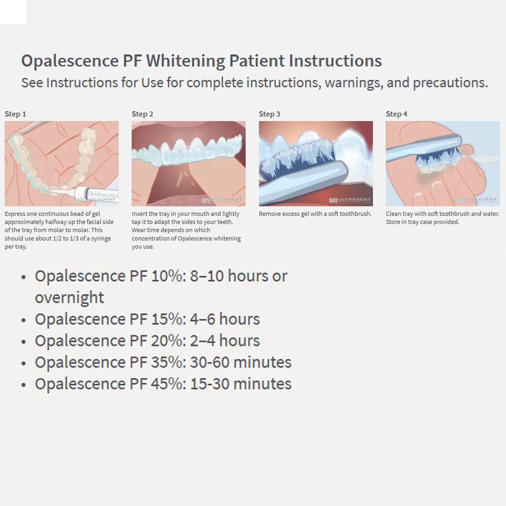 Opalwisdom-Kit de Blanchiment  - Teeth Whitening Remedies avis et prix