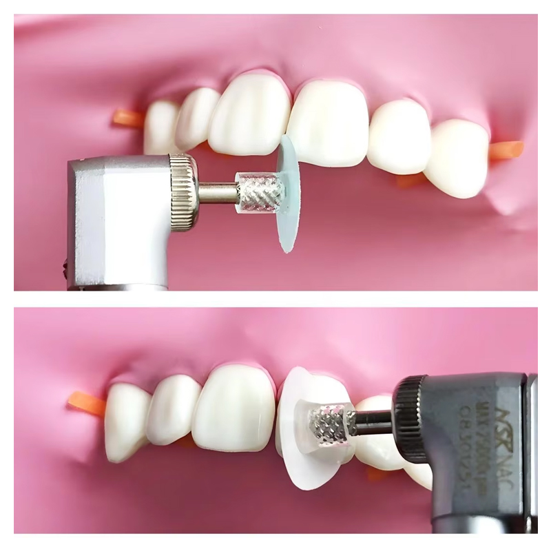 40 disques de polissage dentai - Teeth Whitening Home avis et prix