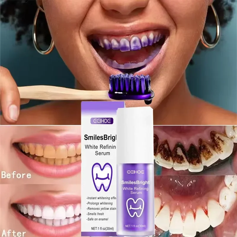 Nettoyage des dents dentifrice - Teeth Whitening Korea avis et prix