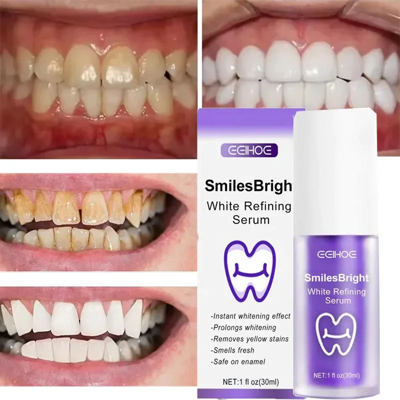 Nettoyage des dents dentifrice - Teeth Whitening Korea avis et prix