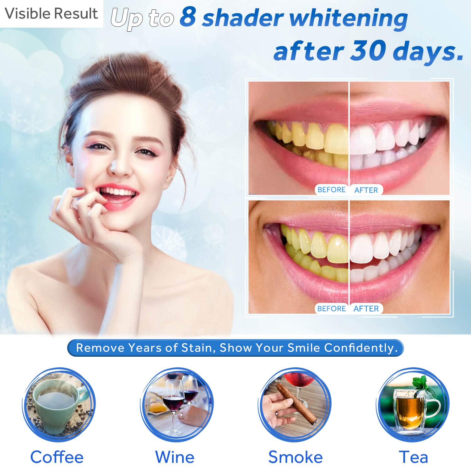 Gel de blanchiment des dents r - Teeth Whitening Gel Peroxide avis et prix