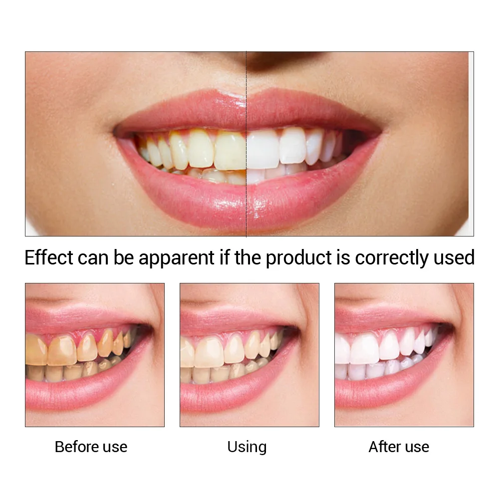 FTEENPLY poudre d'essence de b - Teeth Whitening Remedies avis et prix