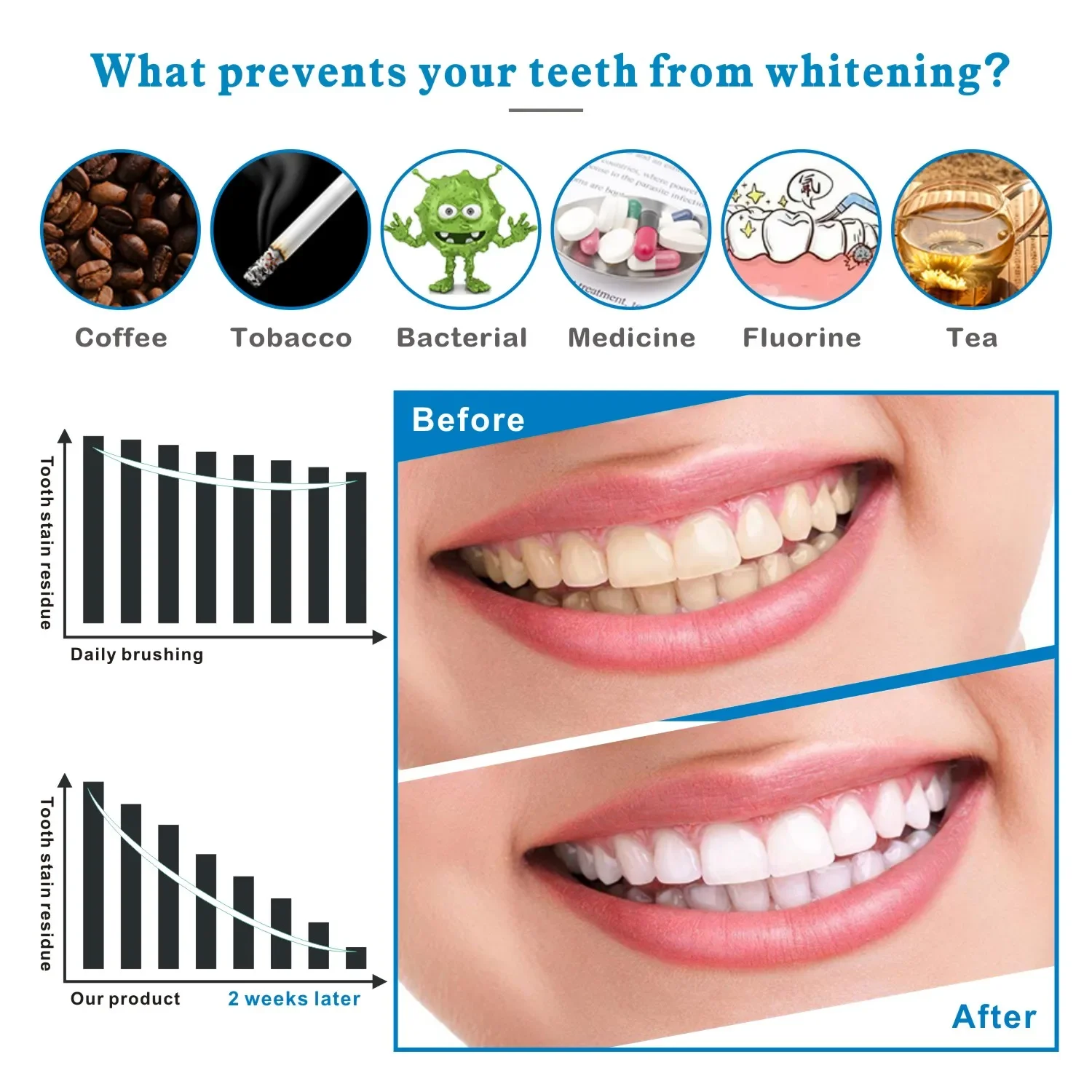 14/28 pièces 3D bandes de blan - Whitening Strip 3D avis et prix