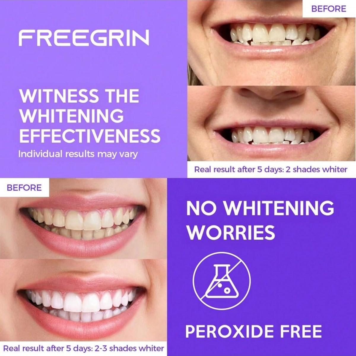 Autocollants de blanchiment de - Teeth Whitening Remedies avis et prix