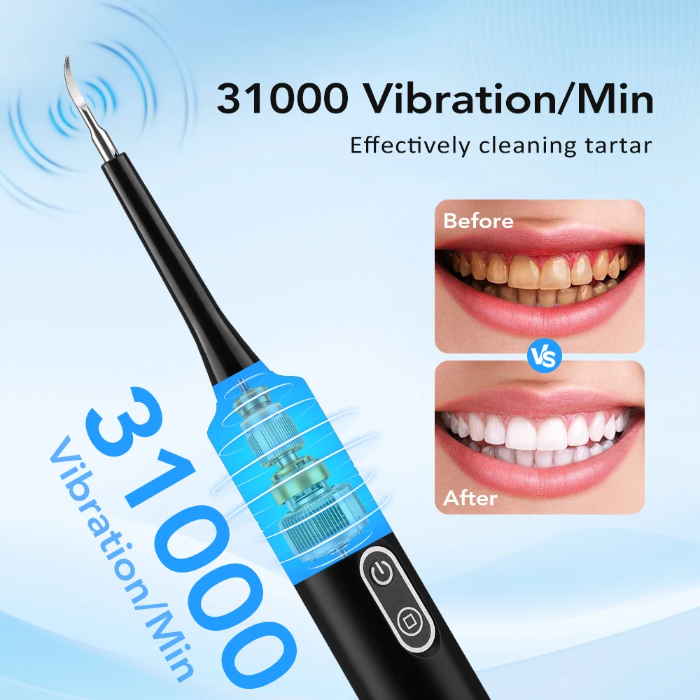 Détartreur dentaire électrique - Teeth Whitening Home avis et prix